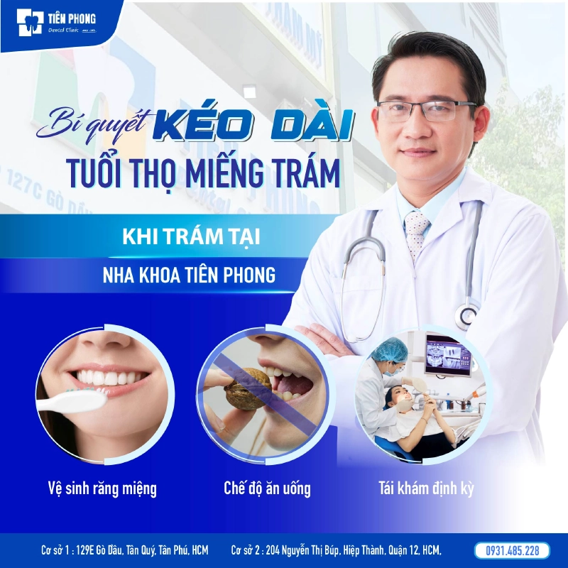 Bí quyết kéo dài tuổi thọ miếng trám