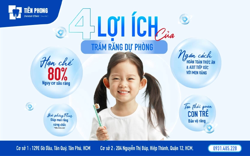 Trám răng dự phòng mang lại nhiều lợi ích