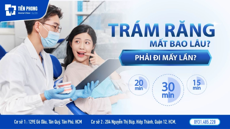 Trám răng mất bao lâu? Cập nhật thời gian chuẩn cho người bận rộn