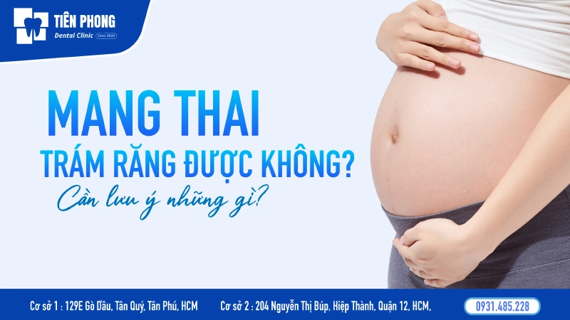 Bà bầu có trám răng được không? Giải đáp an toàn cho mẹ và bé