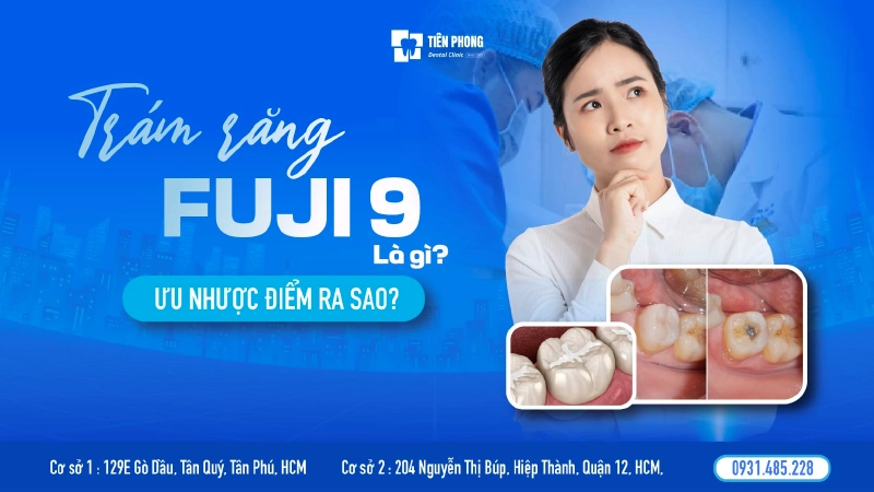 Trám răng Fuji 9 có ứng dụng cao trong 1 số trường hợp