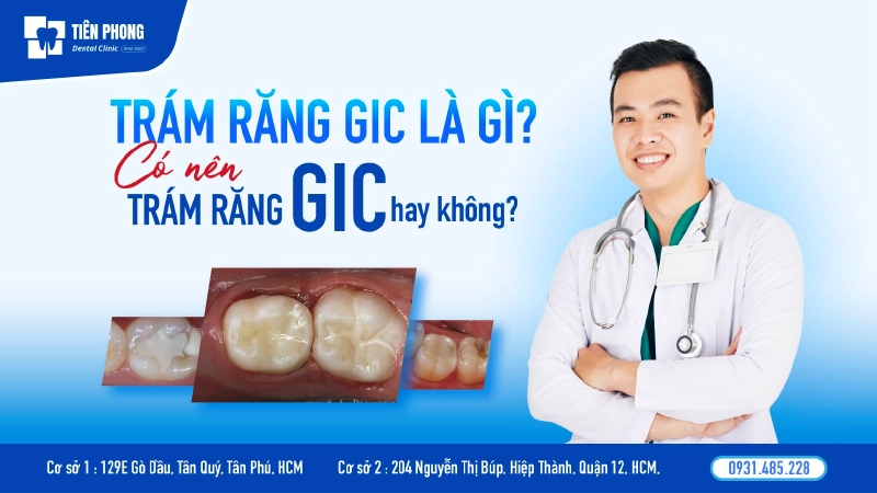 Trám răng GIC là gì? Độ bền, chi phí và quy trình chi tiết nhất