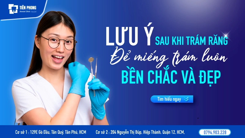 Lưu ý sau khi trám răng để miếng trám luôn bền chắc và đẹp