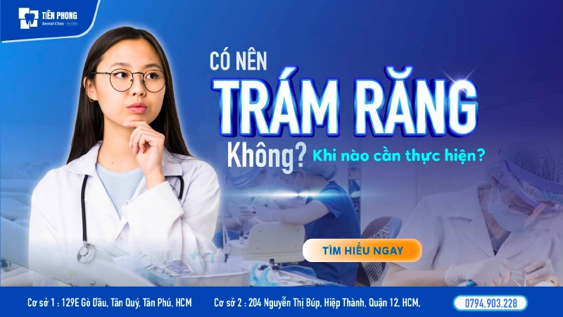 Có nên trám răng không? Khi nào cần thực hiện để đạt hiệu quả tốt nhất?