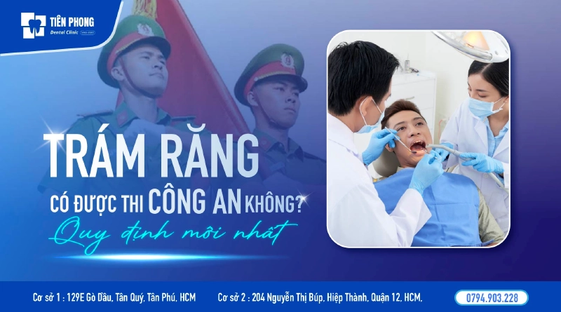 Trám răng có được thi công an không? Quy định mới nhất năm 2026