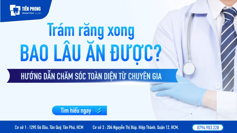 Trám răng xong bao lâu ăn được? Hướng dẫn chăm sóc toàn diện từ chuyên gia