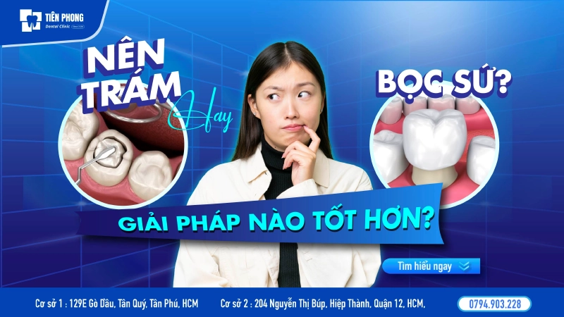 Nên trám răng hay bọc sứ? Giải pháp nào tối ưu cho nụ cười của bạn?