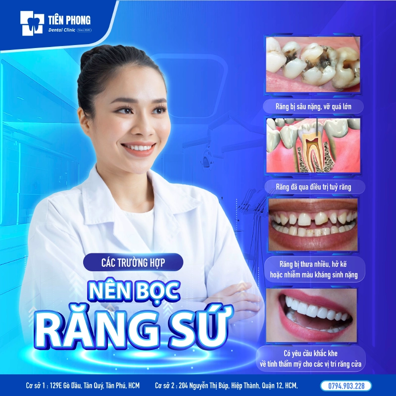 Các trường hợp nên bọc răng sứ Các trường hợp nên bọc răng sứ
