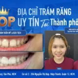 nha khoa trám răng uy tín ở tphcm