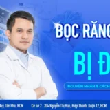bọc răng sứ bị đau
